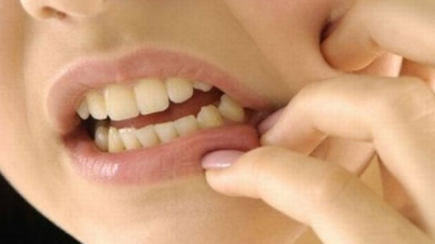 Care sunt optiunile pentru inlocuirea dintilor implantului?